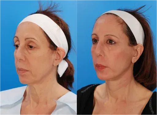 Plastic Surgeon Knoxville - Dr. Megan Jack MD 6 Featured image